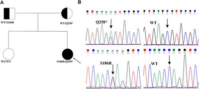 Clinical and functional analyses of the novel STAR c.558C>A in a patient with classic lipoid congenital adrenal hyperplasia